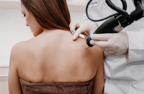 What do I do if I have a skin lesion on my back?