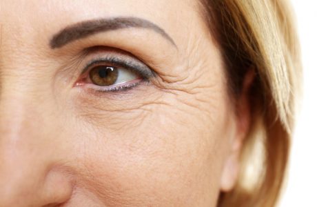 How we perform wrinkle reduction