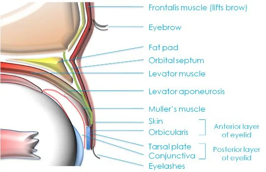 Illustration of eye related to ptosis